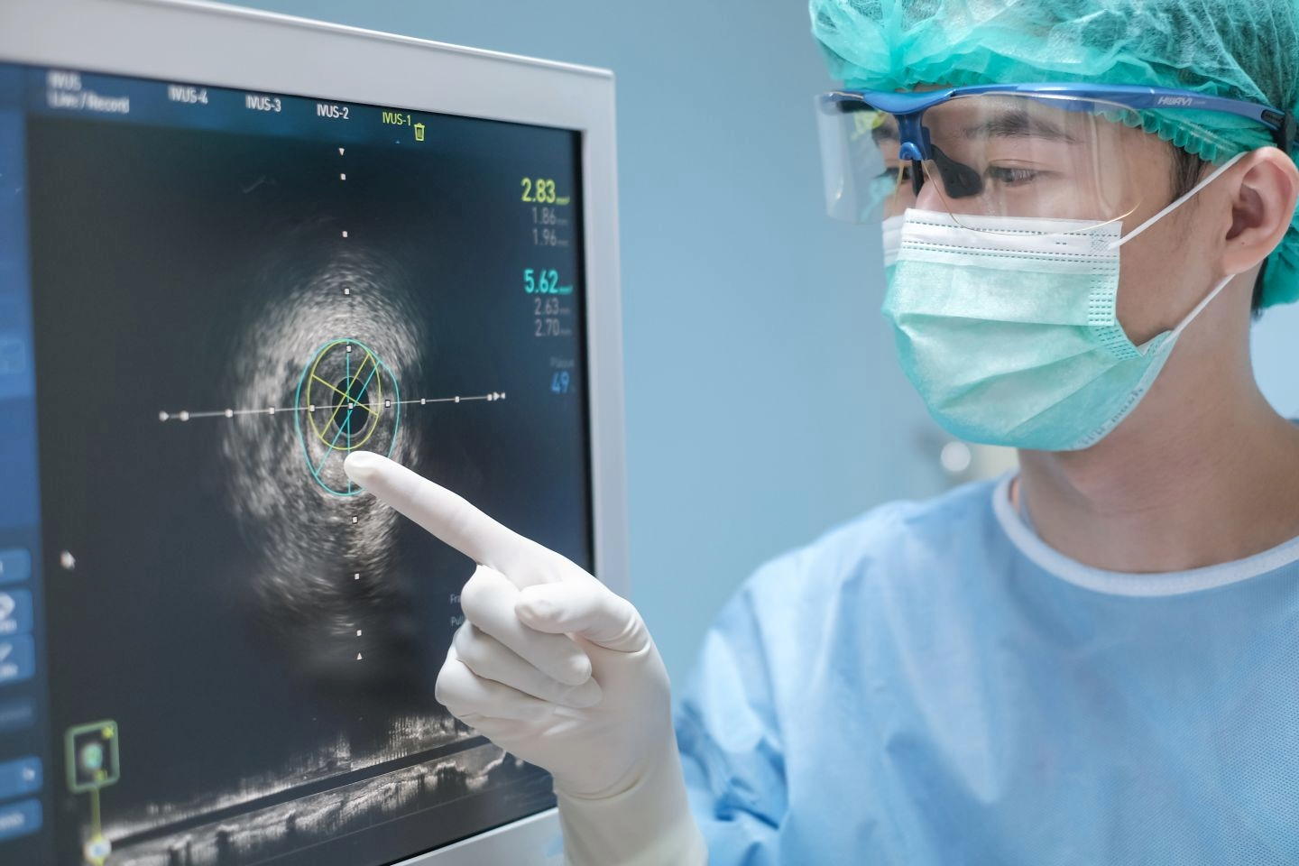 ACC 2026: dulaglutide promotes coronary plaque stabilisation in patients with T2D